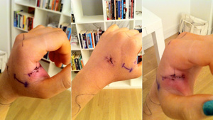 Illustration for article titled Why Cat Bites Are Pretty Much the Worst Thing Ever
